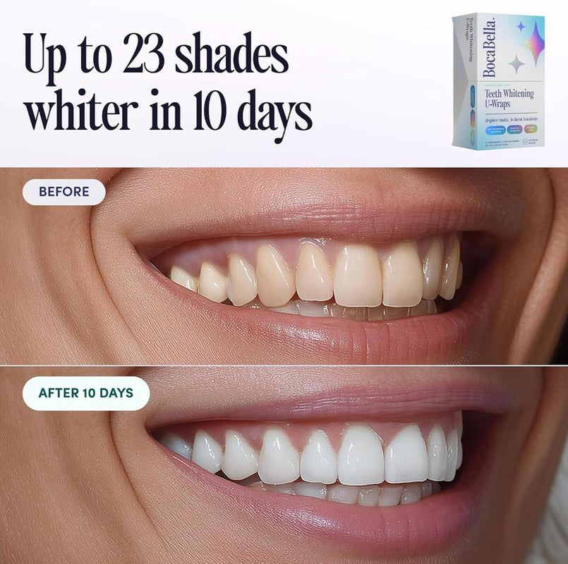 Teeth Whitening U-Wraps – 10 Treatments – 15% Hydrogen Peroxide, Enamel-Safe, No Harsh Sensitivity – Patented Strip Design with Aloe, Calendula & Peppermint – Fast, Even Whitening