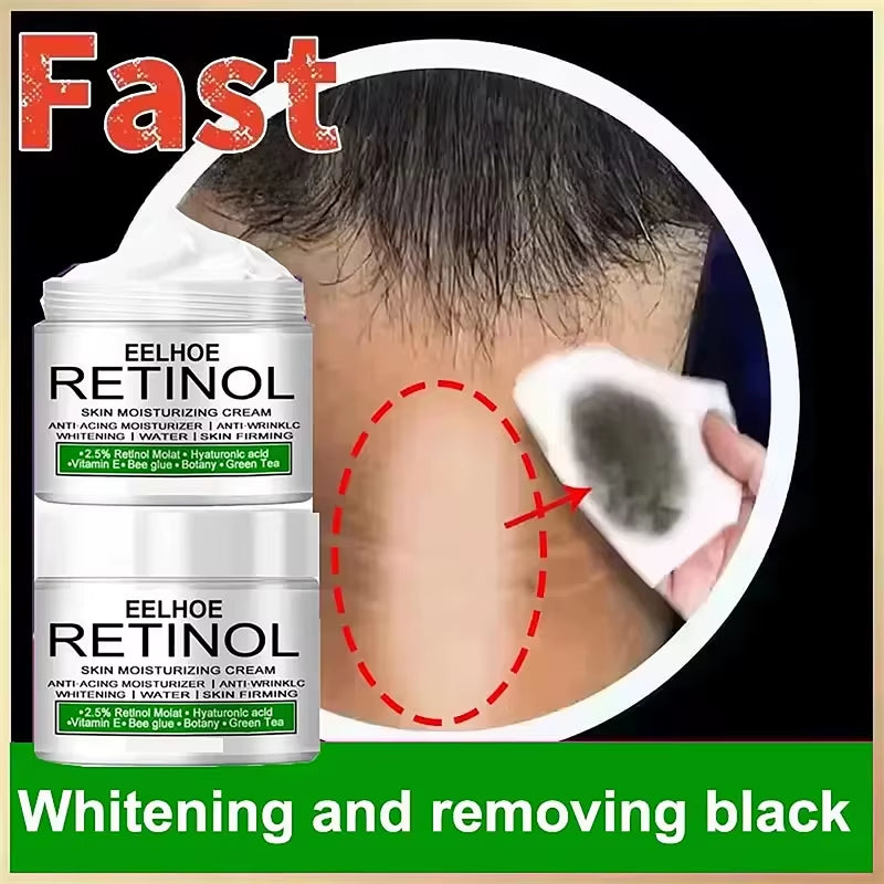 Body Whitening Cream Dark Skin Armpit Lightening Intimate Areas Underarm Bleaching Private Parts Whiten Cream Body Lotion Beauty